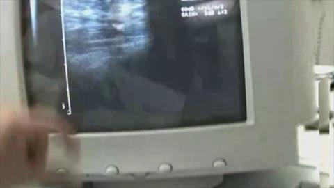 14761